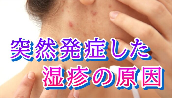 ストレスからウイルス感染による湿疹 | 愛知県大府市の自律神経専門整体院 和屋
